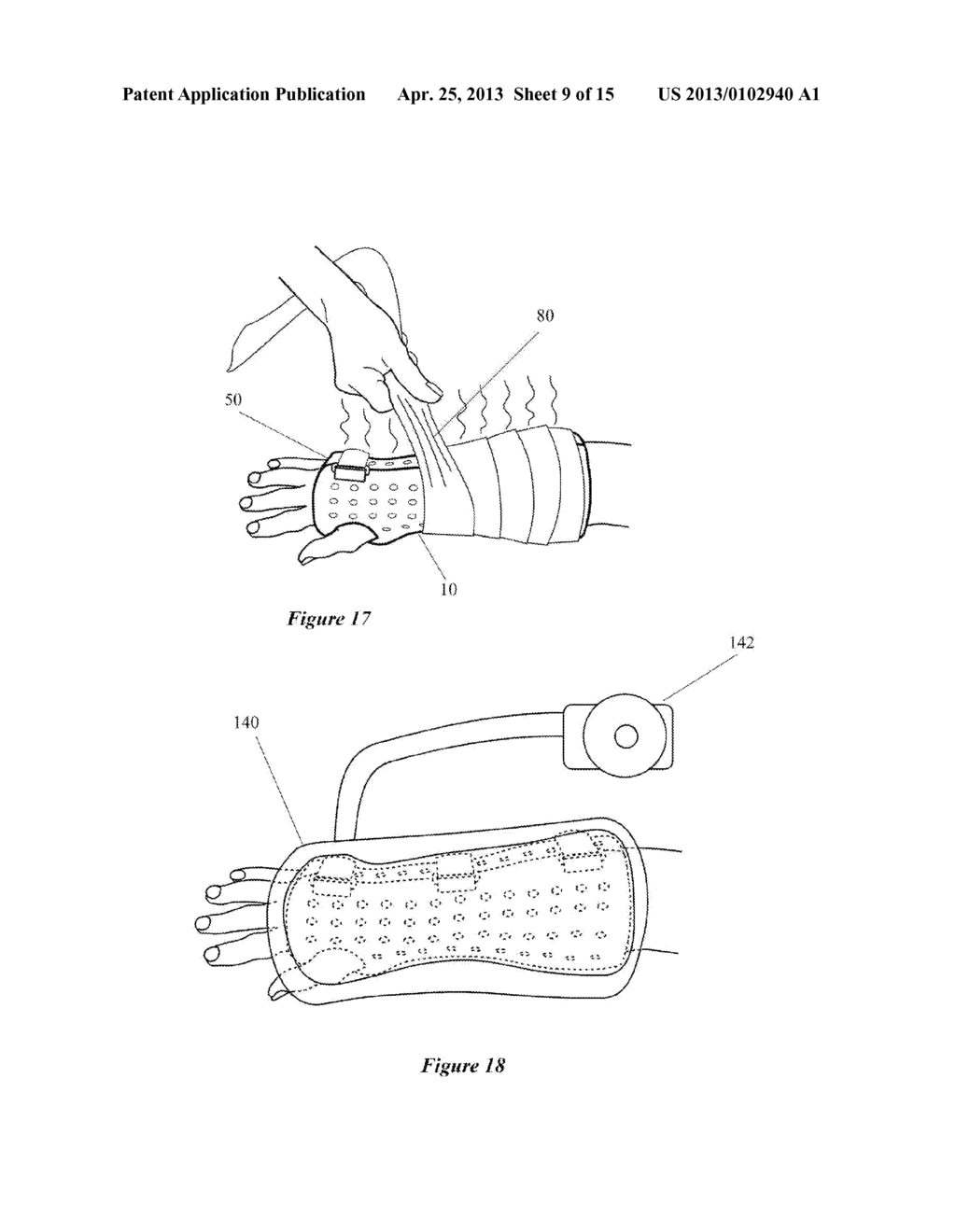 ORTHOPEDIC SYSTEM FOR IMMOBILIZING AND SUPPORTING BODY PARTS - diagram, schematic, and image 10