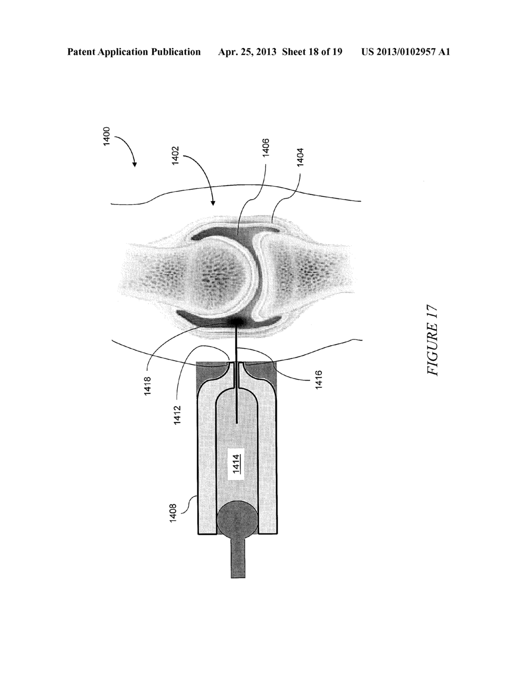 CONTROLLED NEEDLE-FREE TRANSPORT - diagram, schematic, and image 19