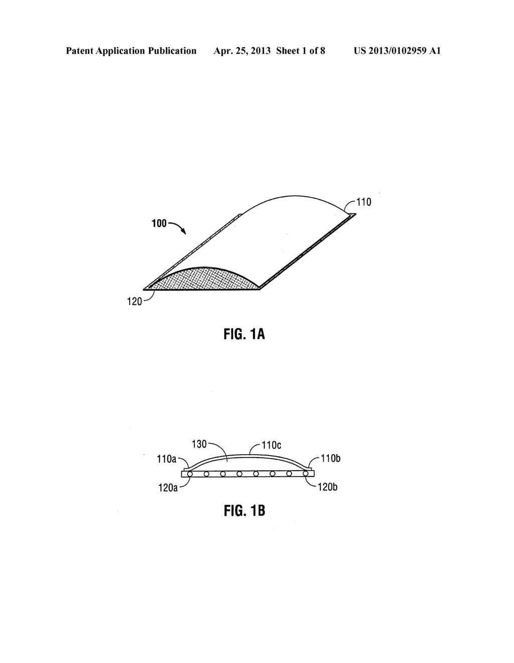 Implantable Film/Mesh Composite - diagram, schematic, and image 02