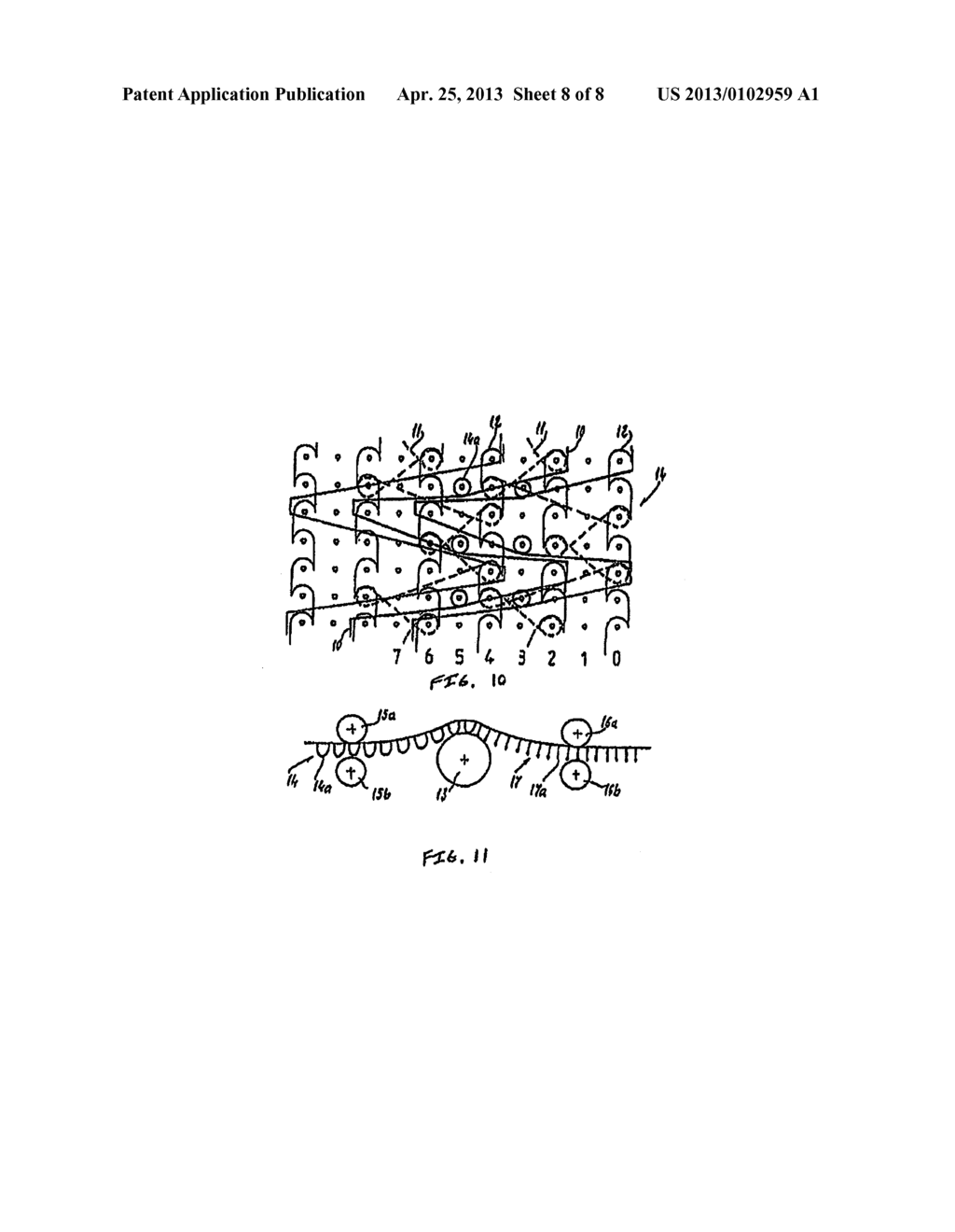 Implantable Film/Mesh Composite - diagram, schematic, and image 09