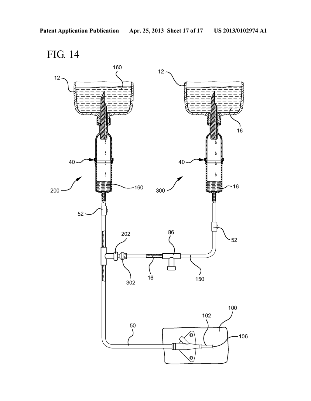 SYSTEMS AND METHODS FOR PROVIDING A CLOSED VENTING HAZARDOUS DRUG IV SET - diagram, schematic, and image 18