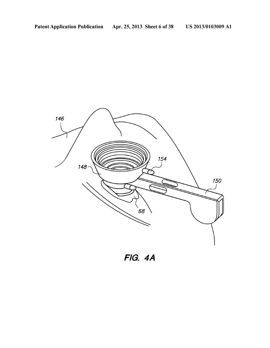 PATIENT INTERFACE FOR OPHTHALMOLOGIC DIAGNOSTIC AND INTERVENTIONAL     PROCEDURES - diagram, schematic, and image 07