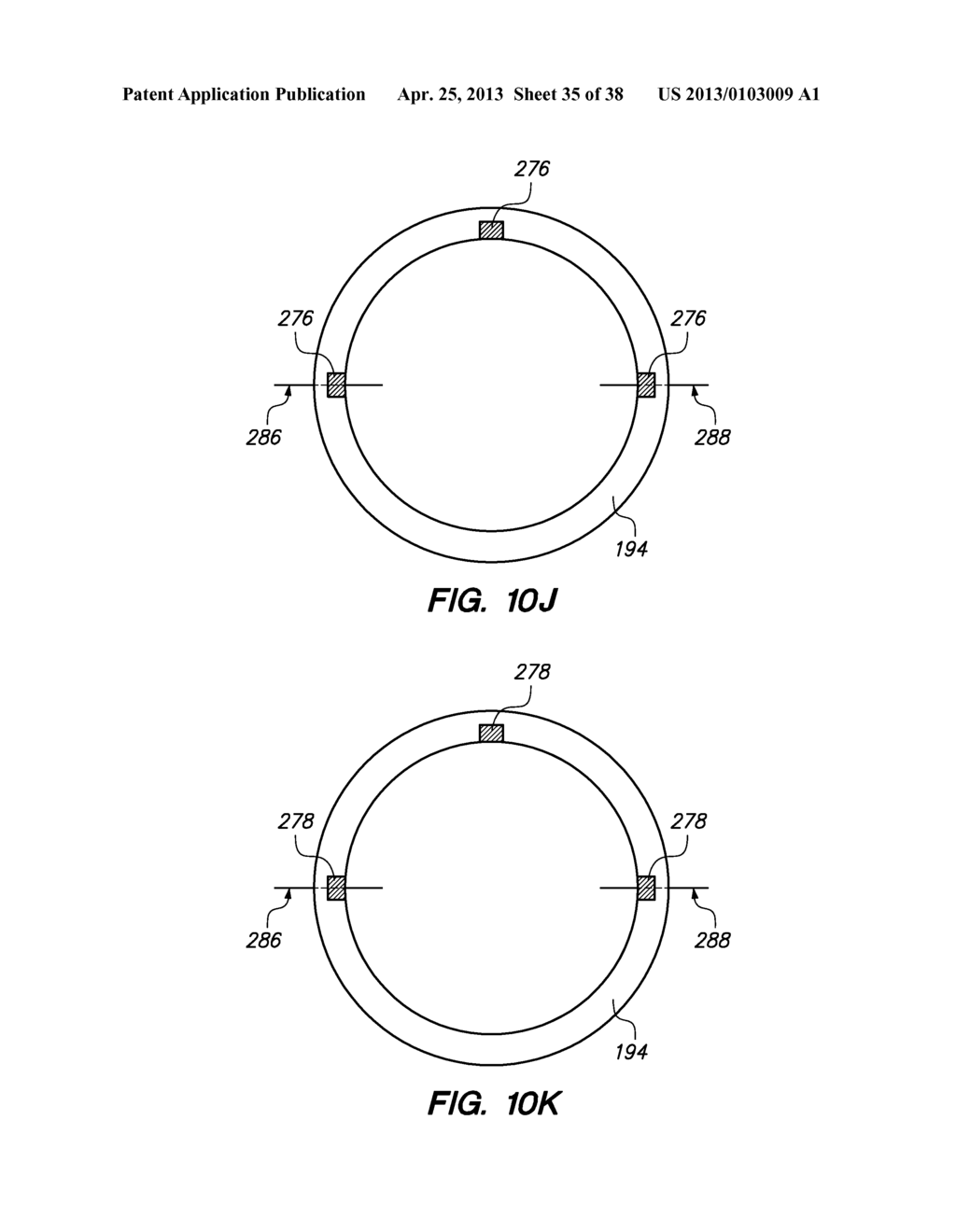 PATIENT INTERFACE FOR OPHTHALMOLOGIC DIAGNOSTIC AND INTERVENTIONAL     PROCEDURES - diagram, schematic, and image 36