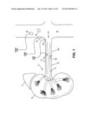 TISSUE TREATMENT DEVICE AND RELATED METHODS diagram and image