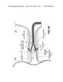 TISSUE TREATMENT DEVICE AND RELATED METHODS diagram and image