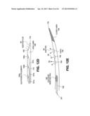 TISSUE TREATMENT DEVICE AND RELATED METHODS diagram and image