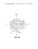 TISSUE TREATMENT DEVICE AND RELATED METHODS diagram and image