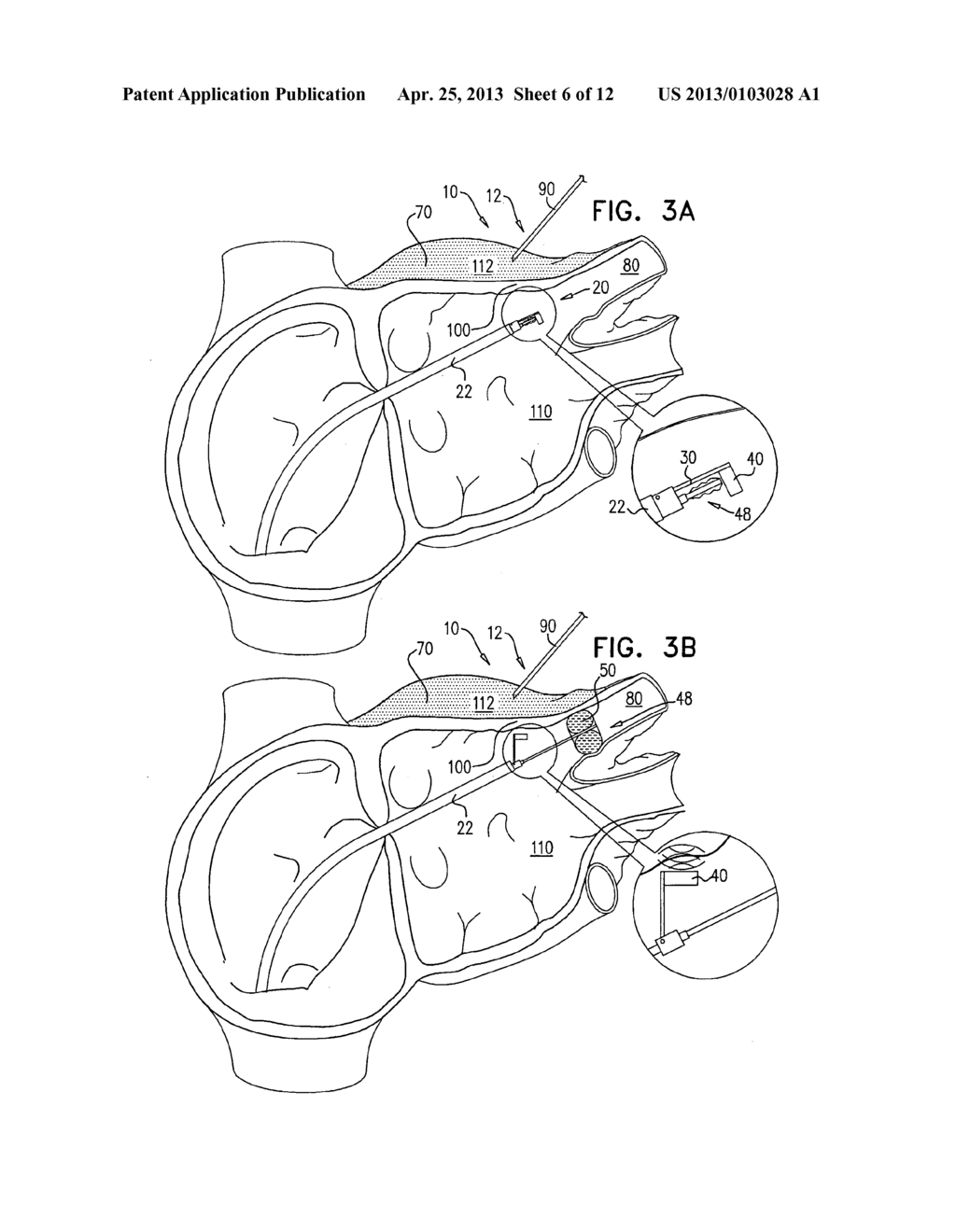 REFLECTANCE-FACILITATED ULTRASOUND TREATMENT AND MONITORING - diagram, schematic, and image 07