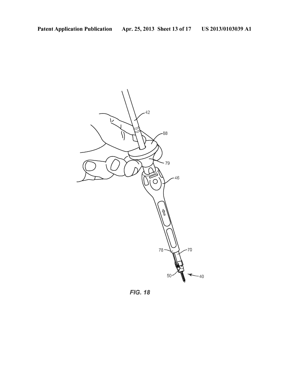 BONE SCREW EXTENDER REATTACHMENT SYSTEM AND METHODS - diagram, schematic, and image 14