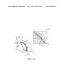 Enhanced Efficacy Lung Volume Reduction Devices, Methods, and Systems diagram and image