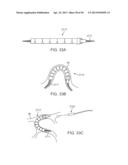 Enhanced Efficacy Lung Volume Reduction Devices, Methods, and Systems diagram and image