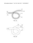 Enhanced Efficacy Lung Volume Reduction Devices, Methods, and Systems diagram and image