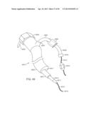 Enhanced Efficacy Lung Volume Reduction Devices, Methods, and Systems diagram and image