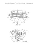 Enhanced Efficacy Lung Volume Reduction Devices, Methods, and Systems diagram and image