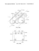 Enhanced Efficacy Lung Volume Reduction Devices, Methods, and Systems diagram and image