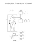 Enhanced Efficacy Lung Volume Reduction Devices, Methods, and Systems diagram and image