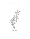 Enhanced Efficacy Lung Volume Reduction Devices, Methods, and Systems diagram and image