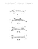 Implantable Film/Mesh Composite diagram and image