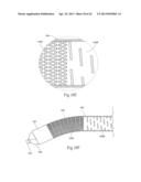 DEVICES, SYSTEMS, AND METHODS FOR PERFORMING ATHERECTOMY INCLUDING     DELIVERY OF A BIOACTIVE MATERIAL diagram and image