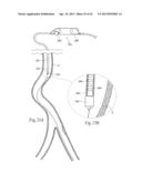 DEVICES, SYSTEMS, AND METHODS FOR PERFORMING ATHERECTOMY INCLUDING     DELIVERY OF A BIOACTIVE MATERIAL diagram and image