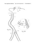 DEVICES, SYSTEMS, AND METHODS FOR PERFORMING ATHERECTOMY INCLUDING     DELIVERY OF A BIOACTIVE MATERIAL diagram and image