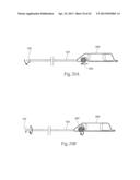 DEVICES, SYSTEMS, AND METHODS FOR PERFORMING ATHERECTOMY INCLUDING     DELIVERY OF A BIOACTIVE MATERIAL diagram and image