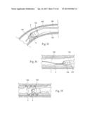 DEVICES, SYSTEMS, AND METHODS FOR PERFORMING ATHERECTOMY INCLUDING     DELIVERY OF A BIOACTIVE MATERIAL diagram and image