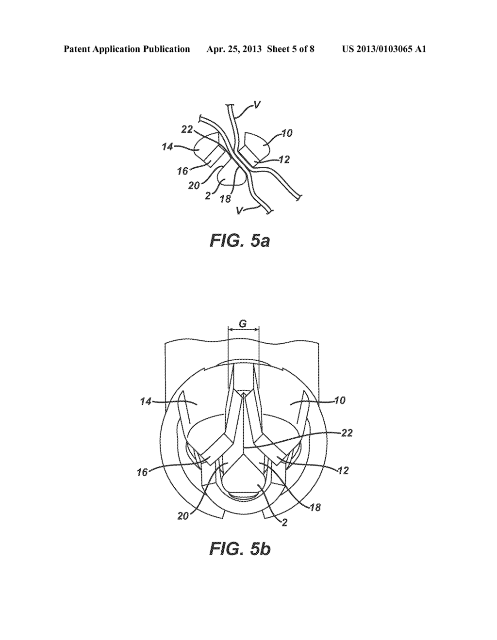 ULTRASONIC DEVICE FOR CUTTING AND COAGULATING - diagram, schematic, and image 06