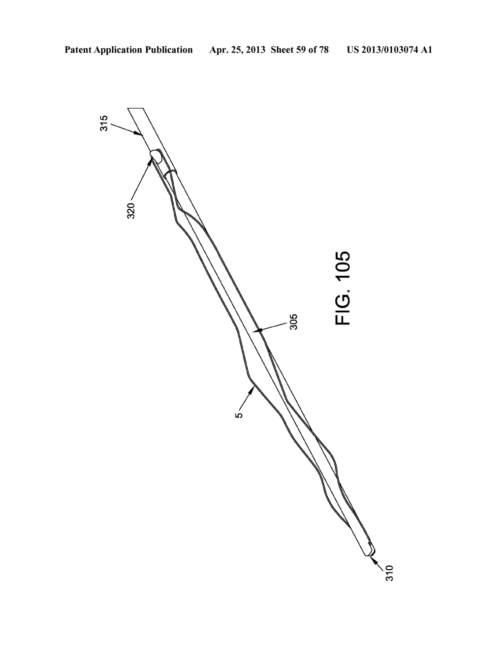 METHOD AND APPARATUS FOR RESTRICTING FLOW THROUGH AN OPENING IN THE SIDE     WALL OF A BODY LUMEN, AND/OR FOR REINFORCING A WEAKNESS IN THE SIDE WALL     OF A BODY LUMEN, WHILE STILL MAINTAINING SUBSTANTIALLY NORMAL FLOW     THROUGH THE BODY LUMEN - diagram, schematic, and image 60