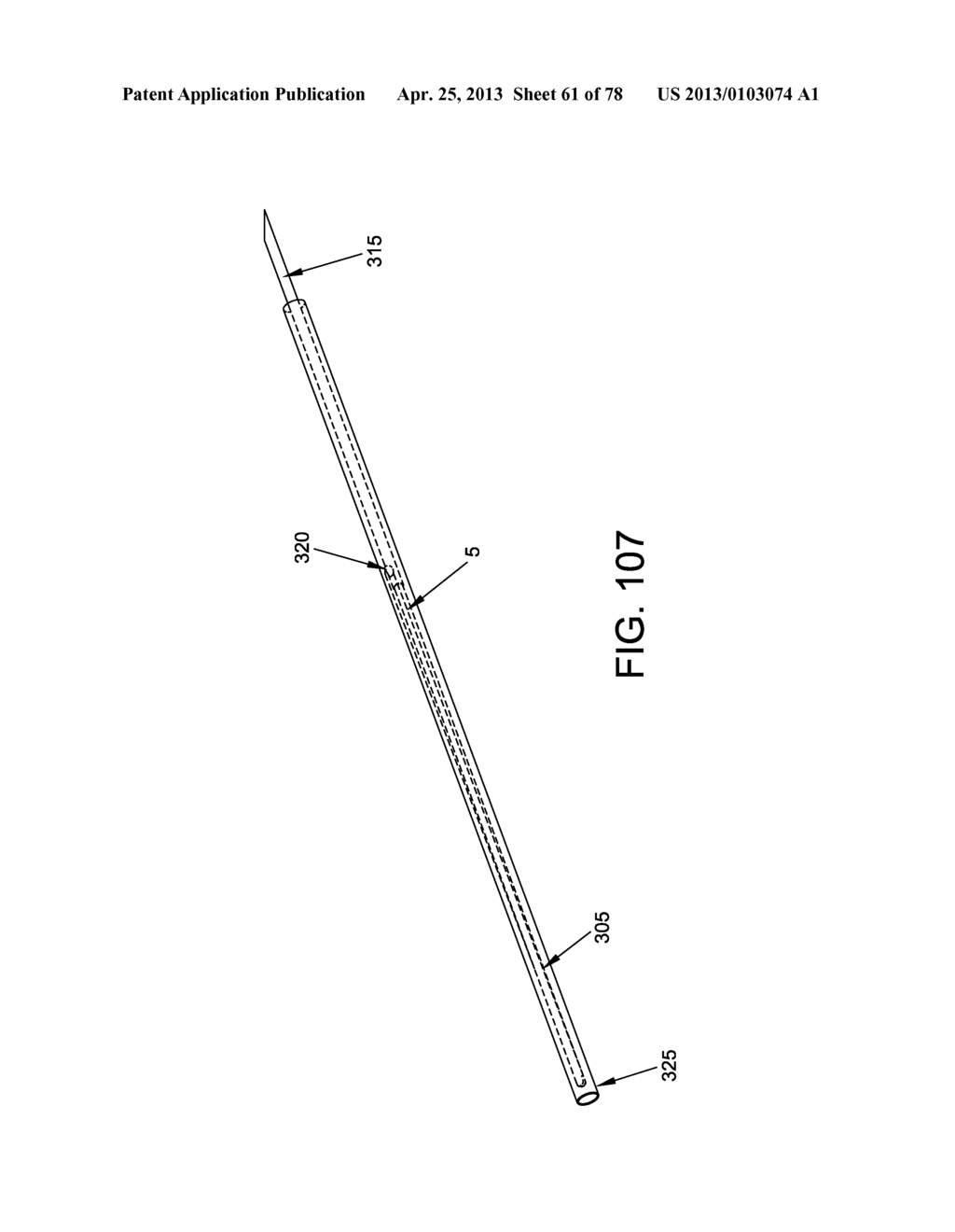 METHOD AND APPARATUS FOR RESTRICTING FLOW THROUGH AN OPENING IN THE SIDE     WALL OF A BODY LUMEN, AND/OR FOR REINFORCING A WEAKNESS IN THE SIDE WALL     OF A BODY LUMEN, WHILE STILL MAINTAINING SUBSTANTIALLY NORMAL FLOW     THROUGH THE BODY LUMEN - diagram, schematic, and image 62