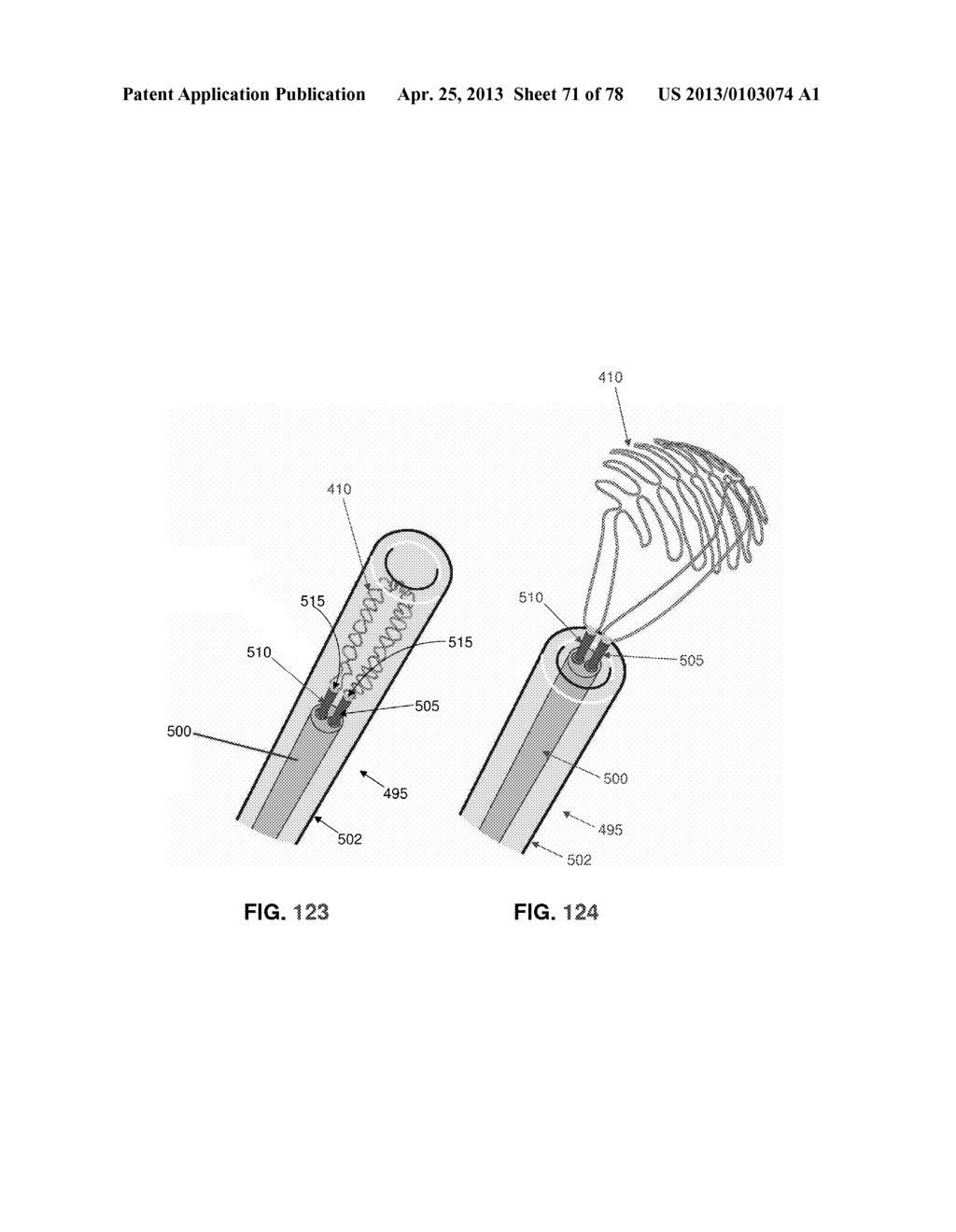 METHOD AND APPARATUS FOR RESTRICTING FLOW THROUGH AN OPENING IN THE SIDE     WALL OF A BODY LUMEN, AND/OR FOR REINFORCING A WEAKNESS IN THE SIDE WALL     OF A BODY LUMEN, WHILE STILL MAINTAINING SUBSTANTIALLY NORMAL FLOW     THROUGH THE BODY LUMEN - diagram, schematic, and image 72