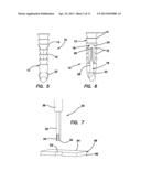 Suture anchors and methods of use diagram and image