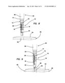 Suture anchors and methods of use diagram and image