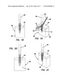 Suture anchors and methods of use diagram and image