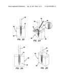 Suture anchors and methods of use diagram and image