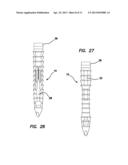 Suture anchors and methods of use diagram and image