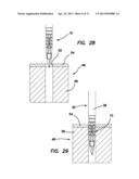 Suture anchors and methods of use diagram and image