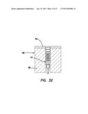 Suture anchors and methods of use diagram and image