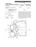 SPINOUS PROCESS MOUNTED SPINAL IMPLANT diagram and image