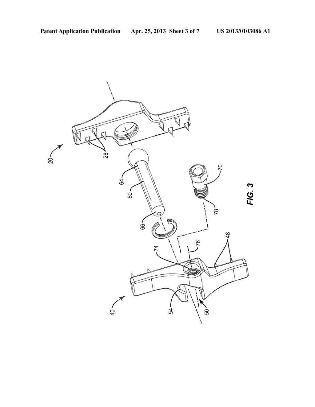 SPINOUS PROCESS MOUNTED SPINAL IMPLANT - diagram, schematic, and image 04