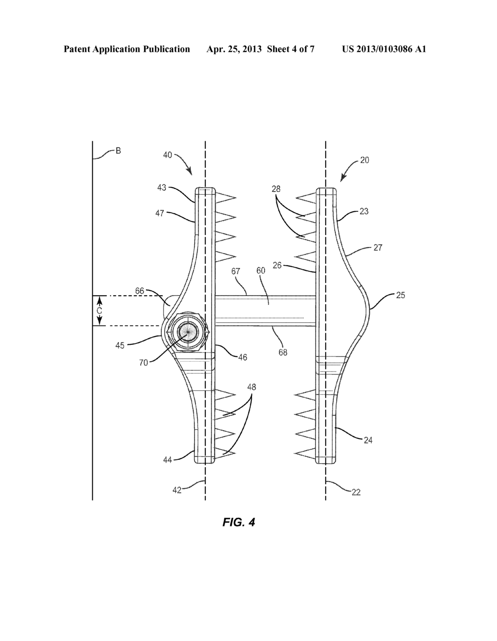 SPINOUS PROCESS MOUNTED SPINAL IMPLANT - diagram, schematic, and image 05