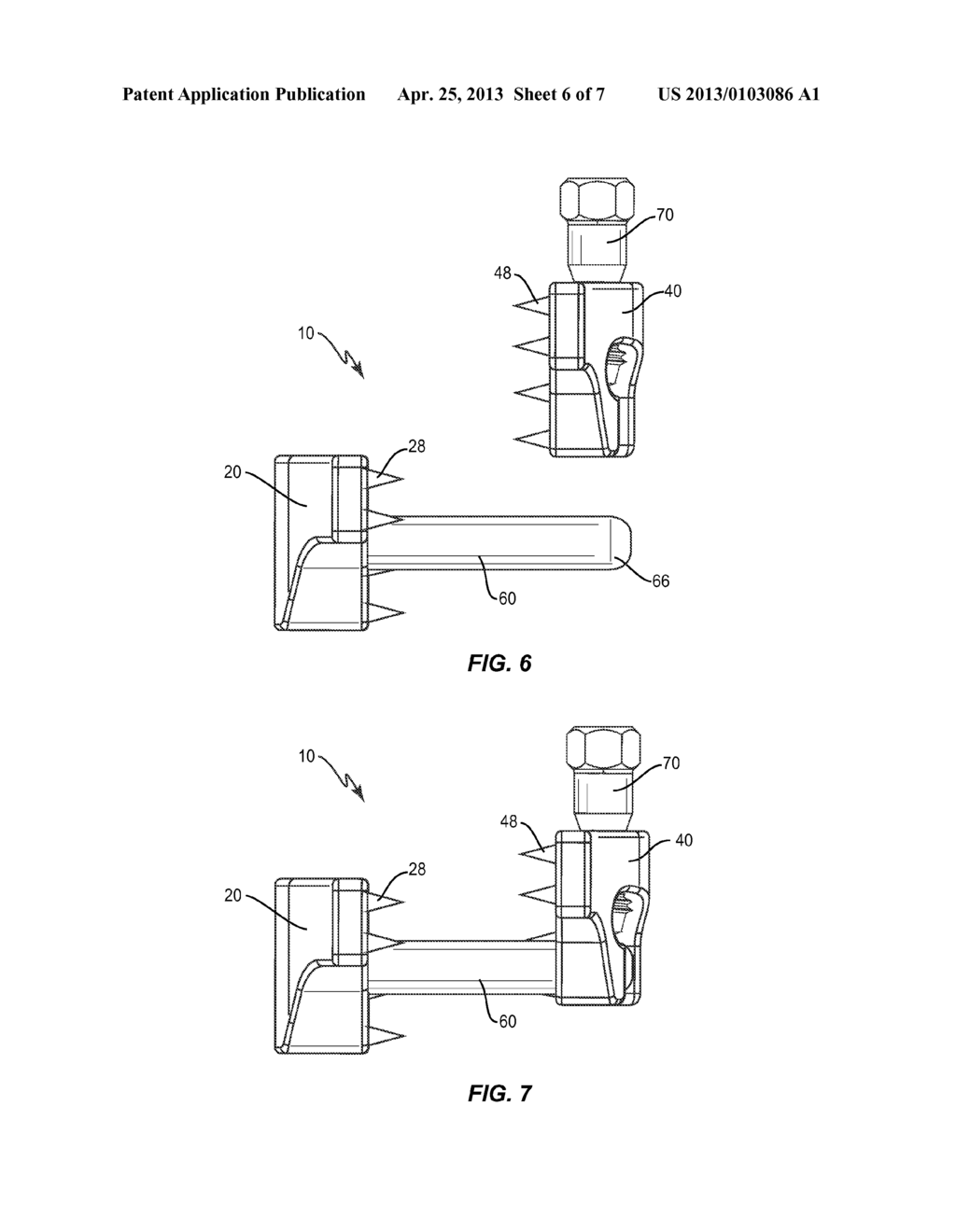 SPINOUS PROCESS MOUNTED SPINAL IMPLANT - diagram, schematic, and image 07