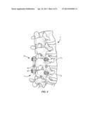 VERTEBRAL ROD SYSTEM AND METHODS OF USE diagram and image