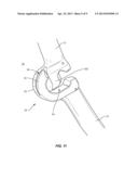 VERTEBRAL ROD SYSTEM AND METHODS OF USE diagram and image