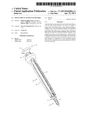 SPINAL IMPLANT SYSTEM AND METHOD diagram and image