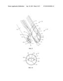 SPINAL IMPLANT SYSTEM AND METHOD diagram and image