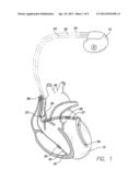 METHOD AND APPARATUS TO INCREASE STROKE VOLUME BY SYNCHRONIZING /     MODULATING HEART RATE WITH ACTIVITY RATE diagram and image