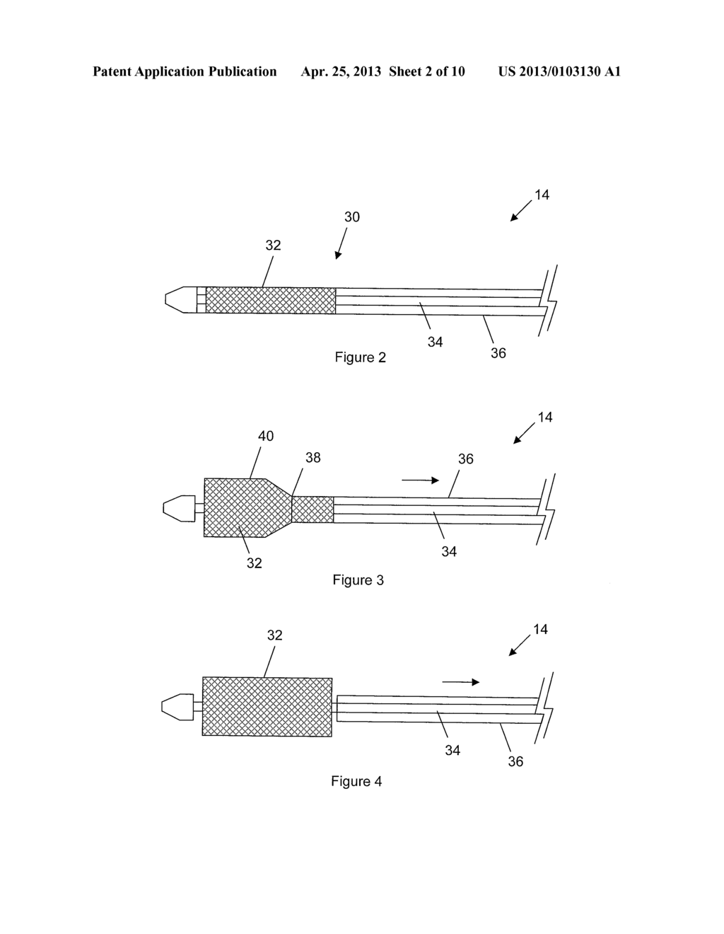 Catheter Assembly With User-Assisting Handle - diagram, schematic, and image 03