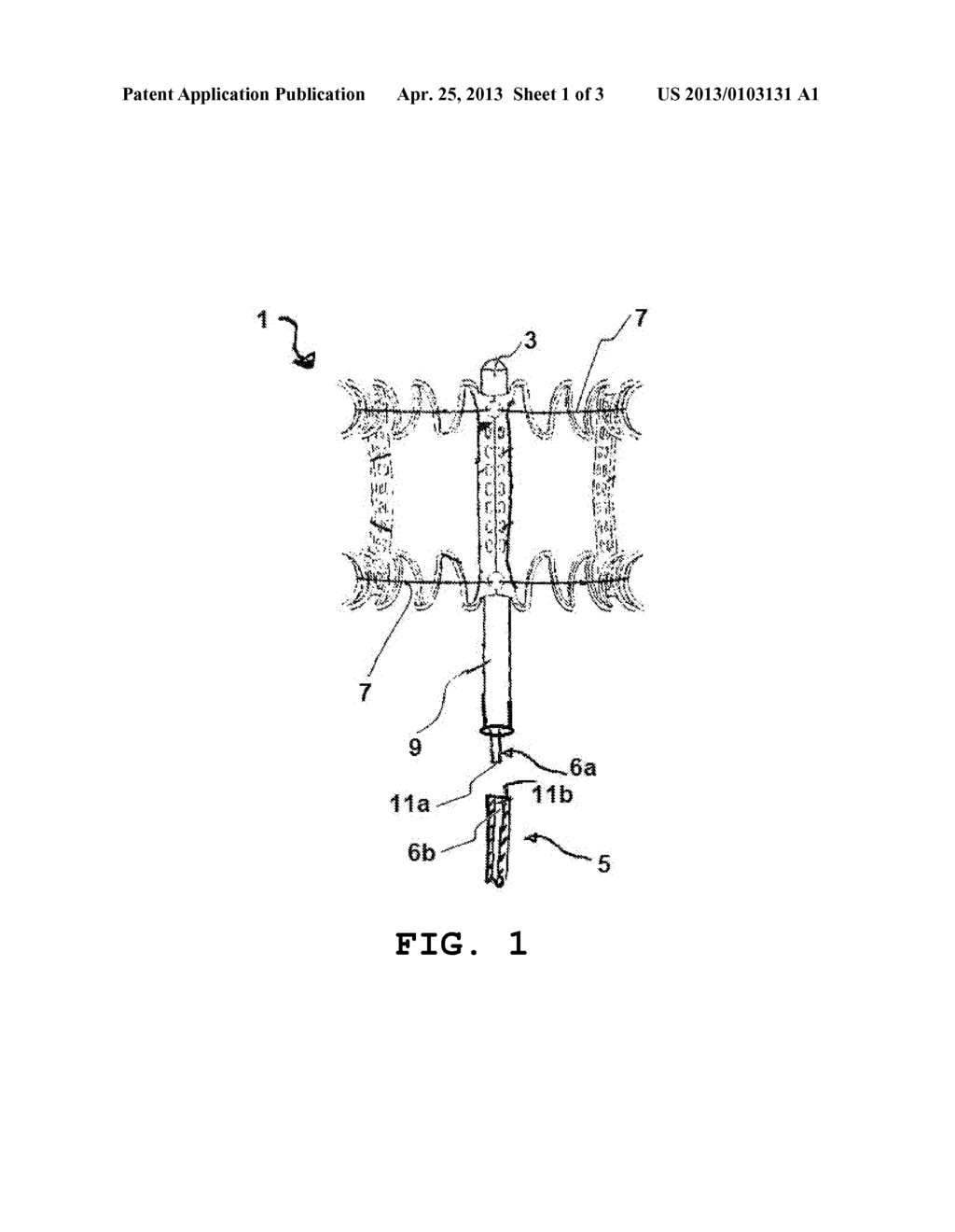 IMPLANT DELIVERY DEVICE ADAPTED TO BE ATTACHED TO OR INTERCONNECTED WITH A     CATHETER, CATHETER AND METHOD - diagram, schematic, and image 02