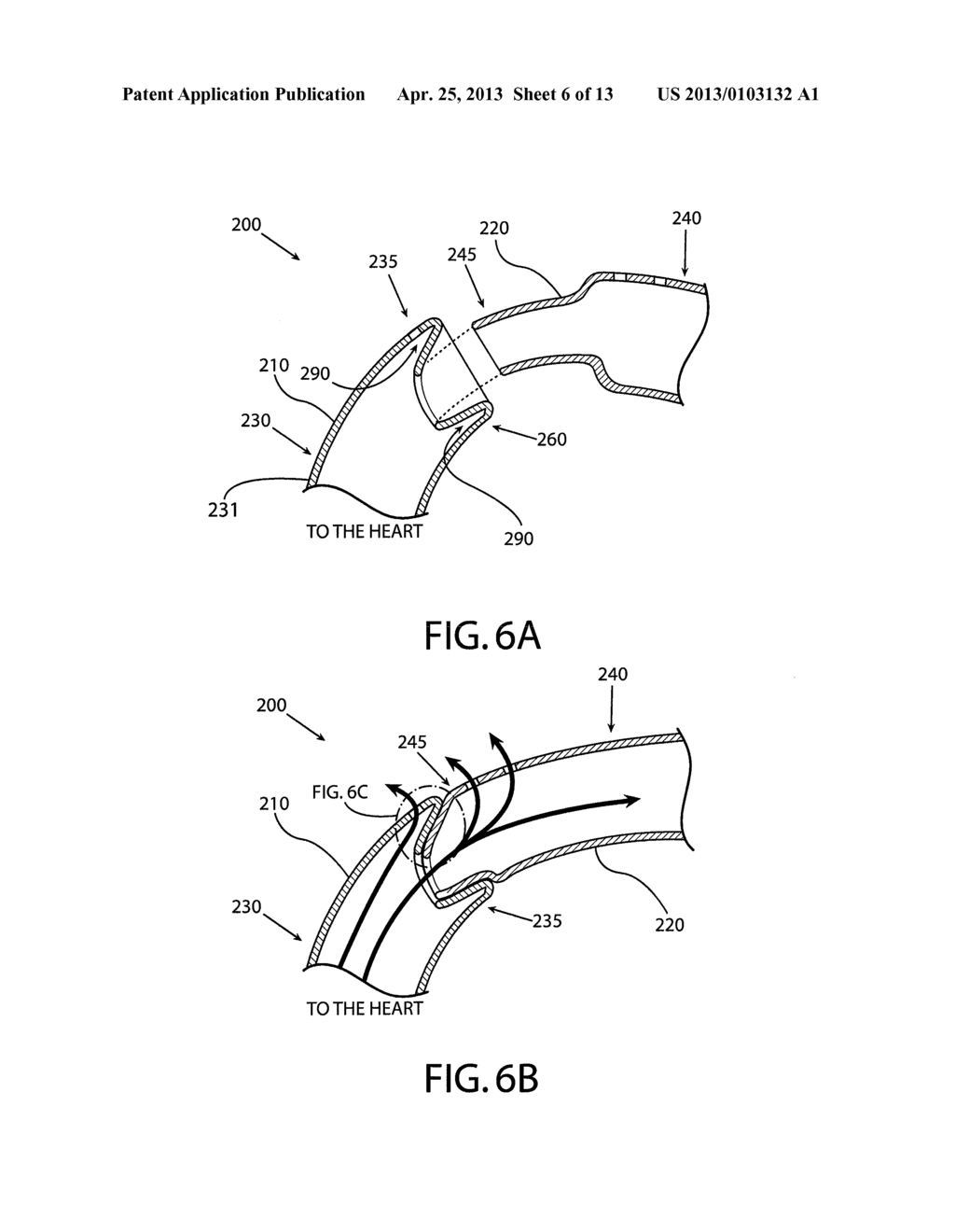 METHOD AND APPARATUS FOR ENDOVASCULAR THERAPY OF AORTIC PATHOLOGY - diagram, schematic, and image 07